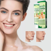 Vitiligo-Cream Vitiligo-Treatment-for-Skin-Vitiligo-Care Vitiligo-Treatment-for-Reduce-White-Spots-and-Improve-Skin
